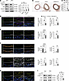 Knockdown of Mettl14 significantly reduced neointima formation in a murine