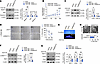 Mettl14 silencing suppresses injury-induced VSMC dedifferentiation in vitro