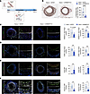 Injury-induced neointima formation can be prevented with early Mettl14 sile