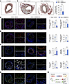 Knockdown of Mettl14 can rescue intimal hyperplasia.