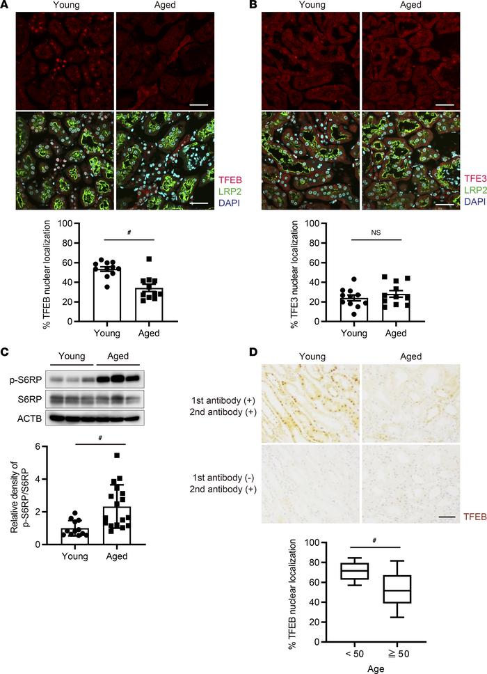 Nuclear TFEB localization in PTECs is downregulated with age.
(A and B) ...