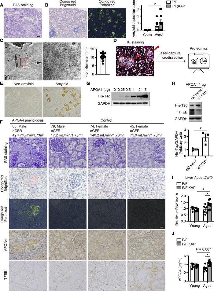 TFEB downregulation in PTECs causes apolipoprotein A4 (APOA4) amyloidosi...