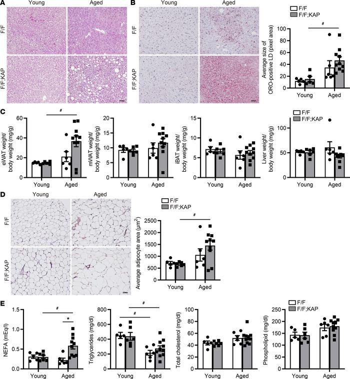 TFEB deficiency in PTECs leads to metabolic disorders in aged mice.
(A a...