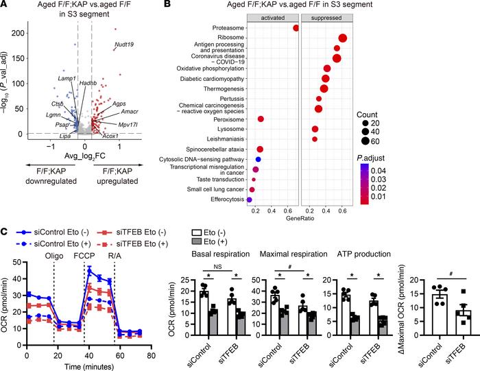TFEB deficiency causes downregulation of the oxidative phosphorylation p...
