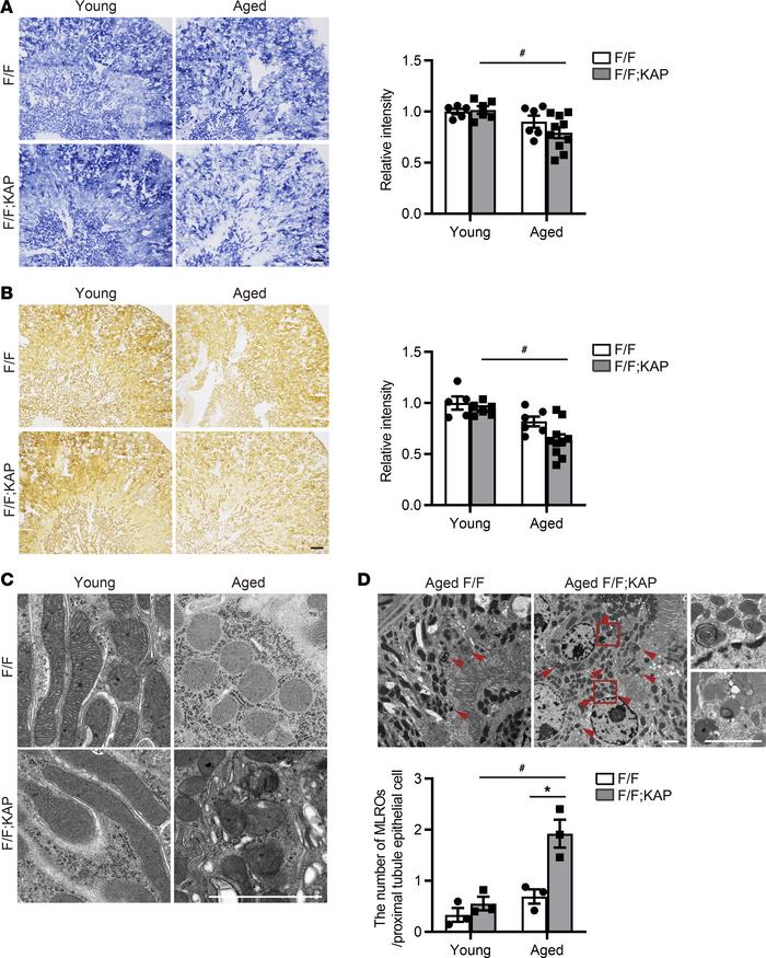 TFEB deficiency aggravates mitochondrial clearance in the S3 segment wit...