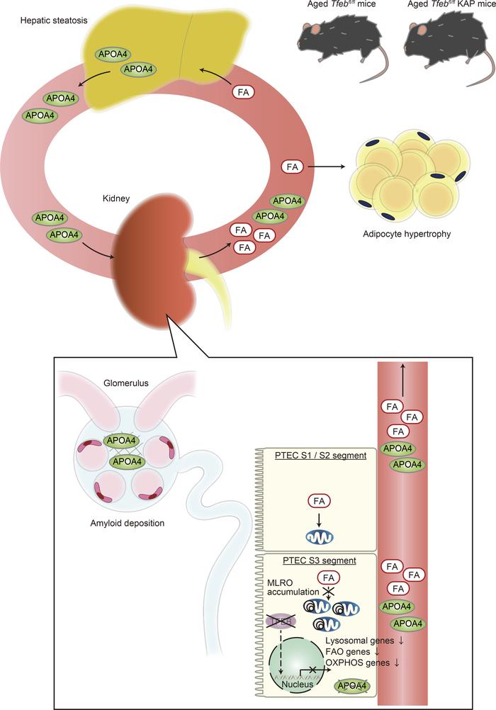 TFEB deficiency in the S3 segment of the proximal tubules causes systemi...