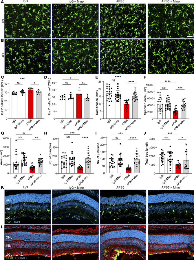 Microglia reactivity is an early event of APB5-induced retinopathy.
(A a...