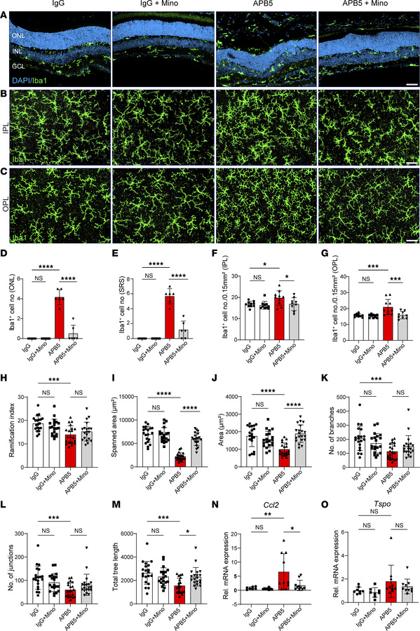 Minocycline limits APB5-triggered microglia reactivity in mature retinas...