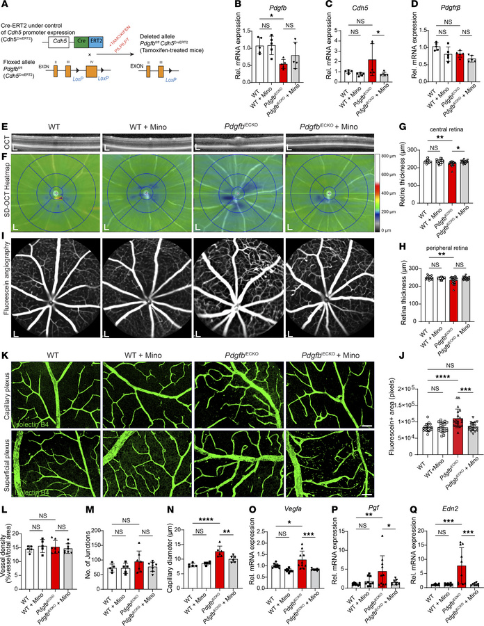 Depletion of PDGFB in retinal vascular endothelium.
(A) Schematic repres...