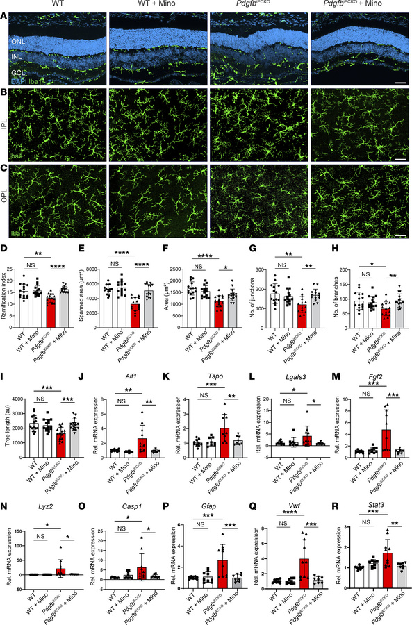 Endothelium-specific conditional deletion of Pdgfb triggers microglia re...