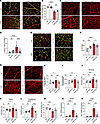 Changes in the structural components of the inner blood retina barrier duri