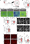 APB5-induced retinopathy triggers changes in retinal visual function and st