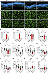 Minocycline limits APB5-triggered microglia reactivity in mature retinas.