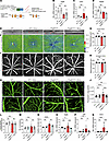 Depletion of PDGFB in retinal vascular endothelium.