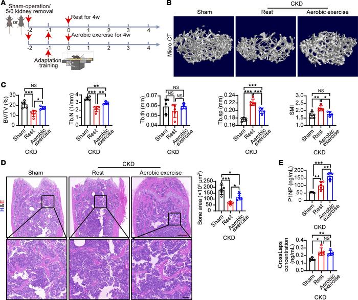 Aerobic exercise ameliorates renal osteodystrophy in CKD mice.
(A) Schem...