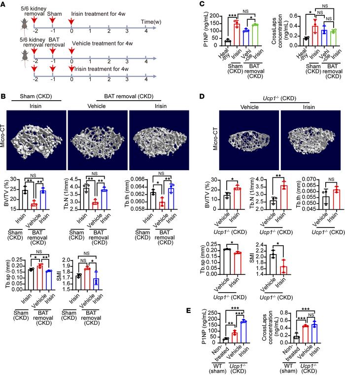 Adipose tissue browning–independent antiosteodystrophy effect of irisin ...