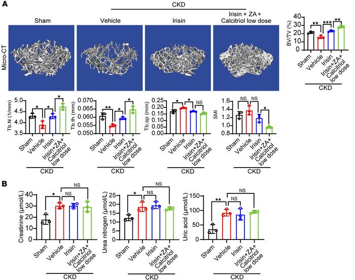 Irisin can be combined with conventional therapies for effective antiost...