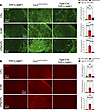 Interneuron-specific TPP1 deficiency does not trigger the neuroimmune respo