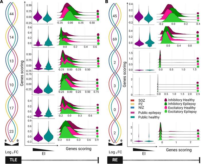 Transcriptional signatures associated with epileptogenicity index in epi...