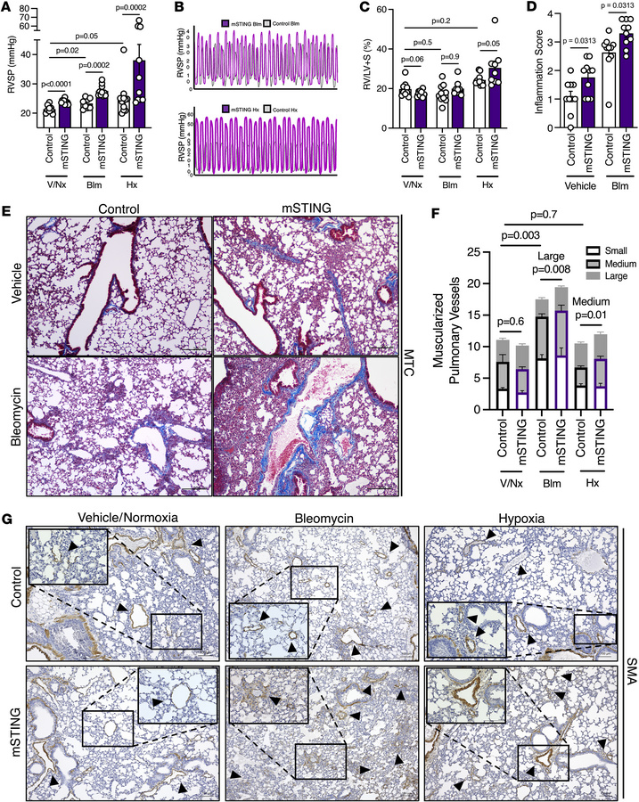 STING expression on myeloid cells is necessary to prevent severe PH.
(A ...