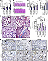 STING expression on myeloid cells is necessary to prevent severe PH.