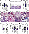 Anti–PD-L1 antibody abrogates severe PH in mSTING mice.