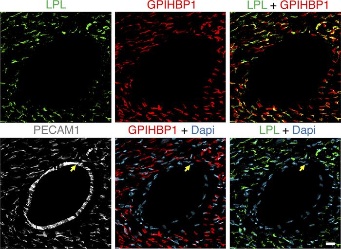 Confocal micrographs of LPL, GPIHBP1, and PECAM1 expression in mouse hea...