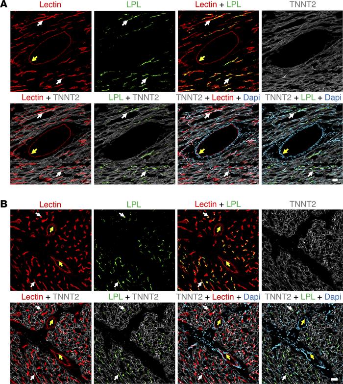 IHC studies of chicken heart showing that LPL is present on capillaries ...