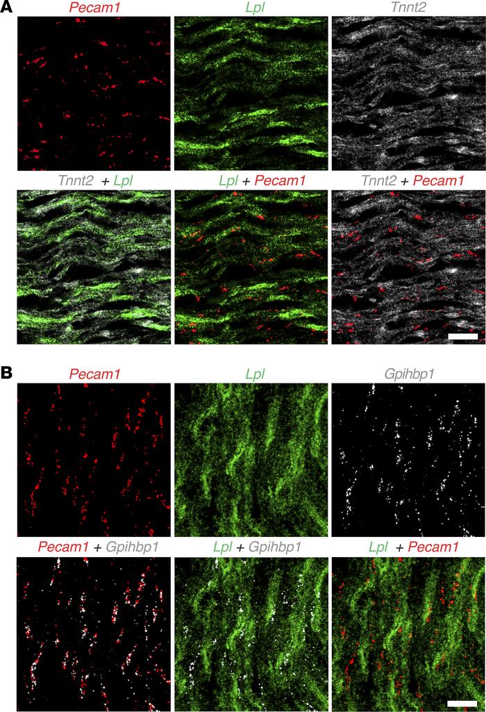 ISH studies on mouse heart with RNAscope probes for Lpl, Tnnt2, Pecam1, ...