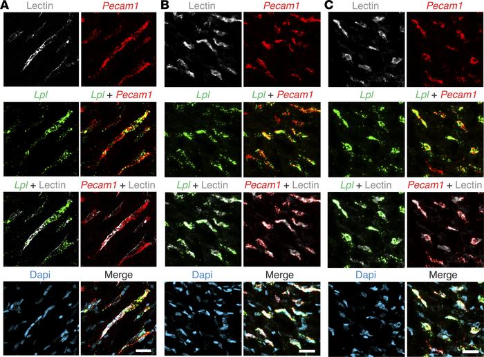 ISH studies of chicken heart with RNAscope probes against Lpl and Pecam1...