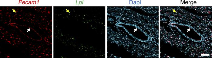 ISH studies of chicken heart with RNAscope probes against Lpl and Pecam1...