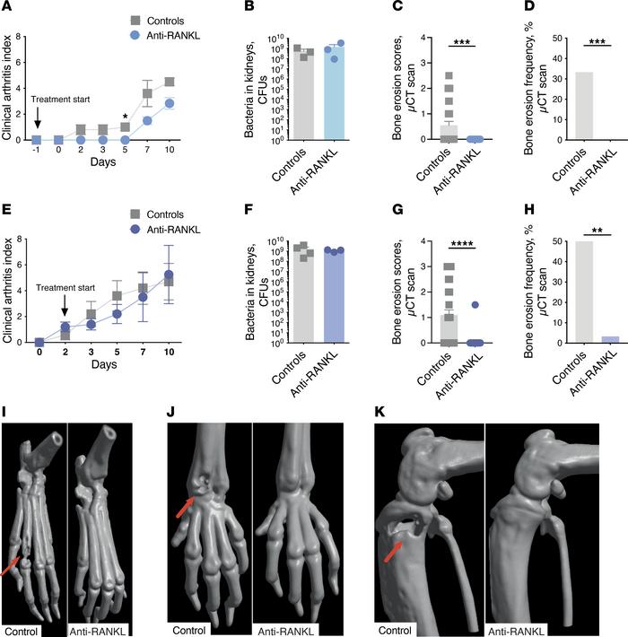 Anti-RANKL treatment prevents bone destruction in mice with hematogenous...