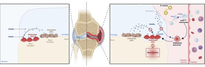 Modulating the monocyte transition to osteoclast-like cells to prevent b...