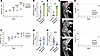 Monocytes are pathogenic while neutrophils are protective in septic arthrit