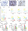 Infiltrating synovial Ly6Chi monocytes exhibit increased expression of oste