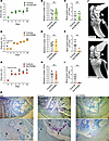 Anti-RANKL treatment provides robust protection against bone destruction in