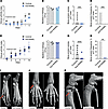 Anti-RANKL treatment prevents bone destruction in mice with hematogenous se