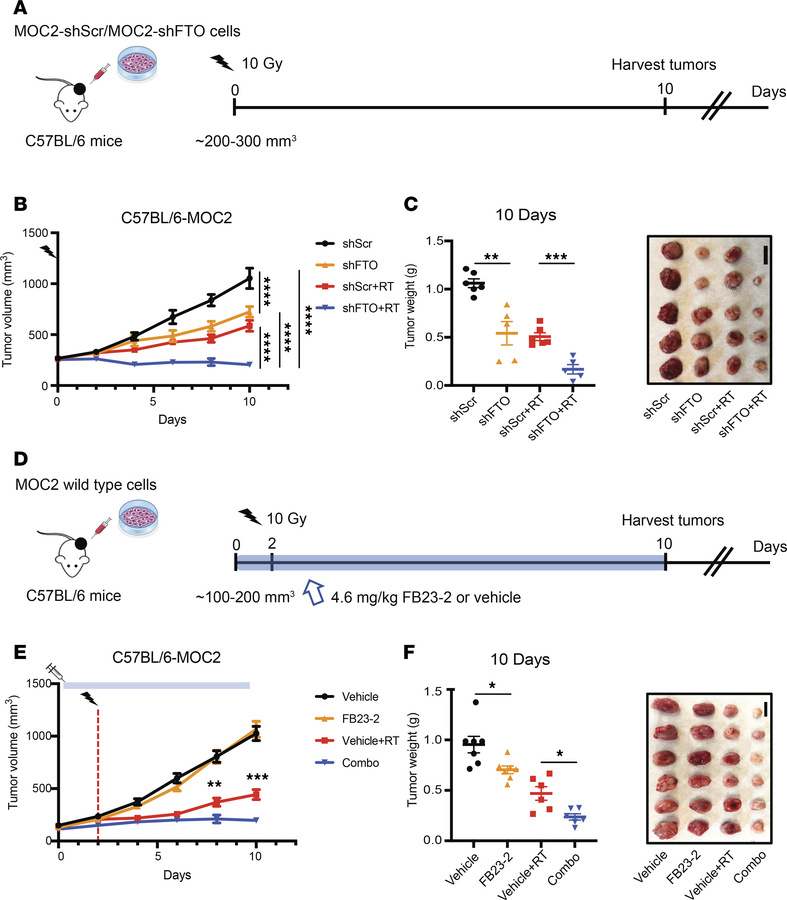 FTO inhibition enhances the radiation response of MOC2 murine HNSCC tumo...