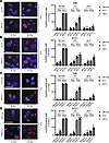 FTO inhibition results in persistent DNA damage in HPV– HNSCC cells after i