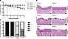FTO inhibition does not increase radiation-induced oral mucositis.