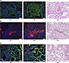 CD13 is highly expressed in lungs from patients with COVID-19.