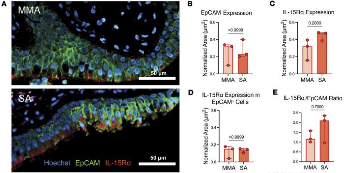 IL-15Rα is detectable by immunofluorescence in the airways of patients w...