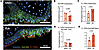 IL-15Rα is detectable by immunofluorescence in the airways of patients with