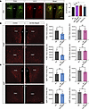 Disruption of hypothalamic melanocortin circuits in Del Ndn-Magel2 mice.
