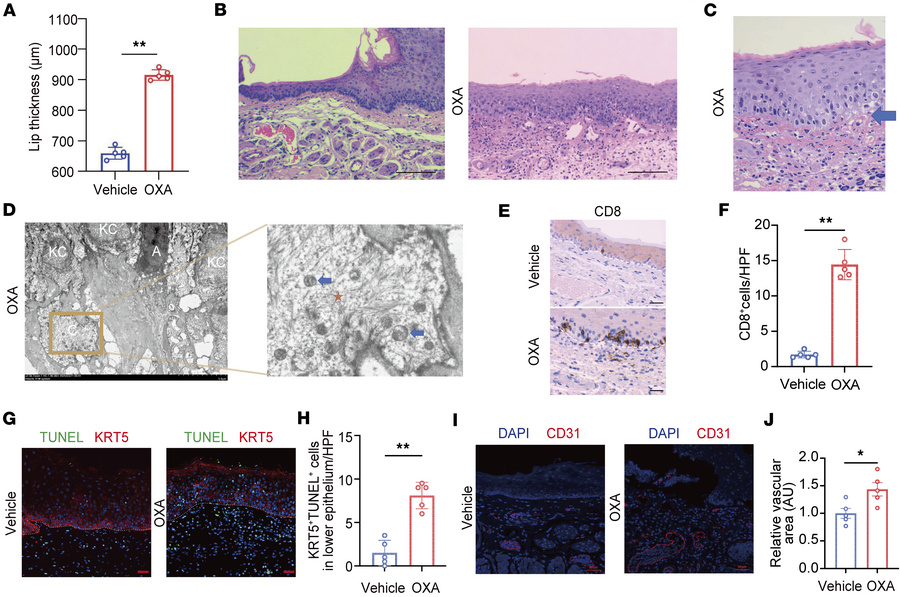 Establishment of an OLP-like mouse model.
(A) Measurement of lip thickne...
