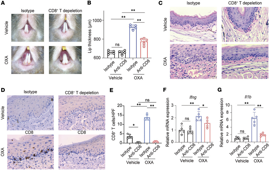 CD8+ T cells are essential for the development of an OLP-like model.
CD8...