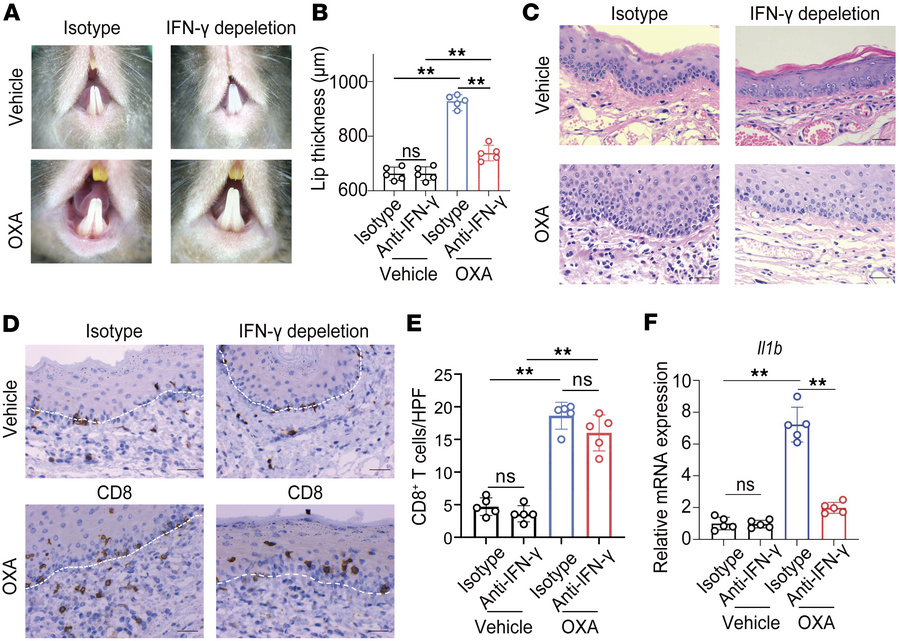 Neutralization of IFN-γ ameliorates OLP-like lesions.
IFN-γ was neutrali...