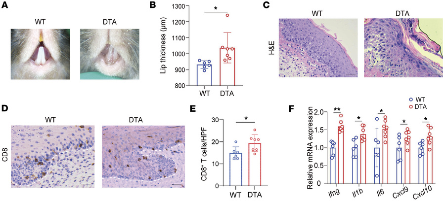 Absence of Langerhans cells exacerbates OLP-like lesions.
(A) Dermoscopi...