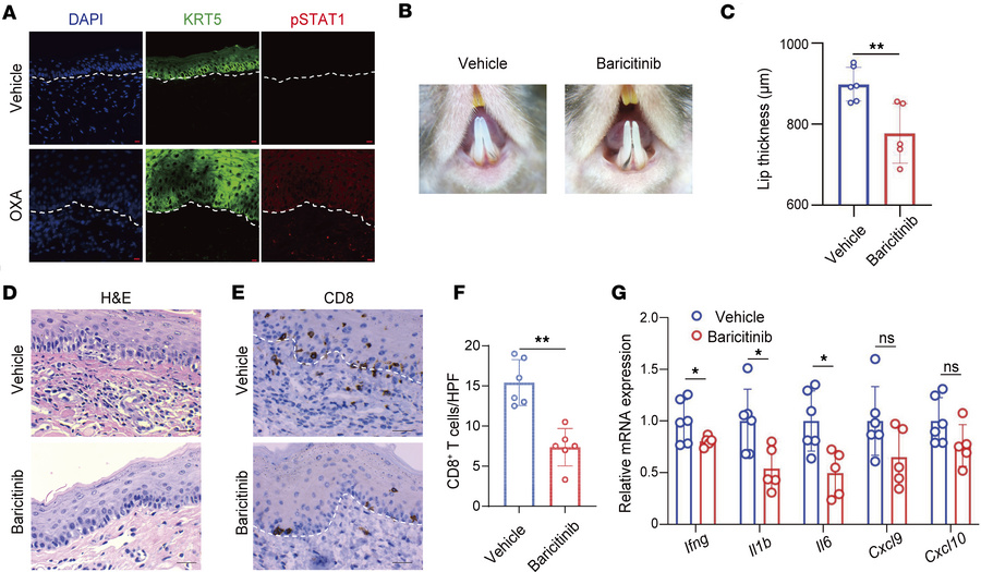 The JAK inhibitor baricitinib ameliorates OLP-like lesions.
(A) Represen...