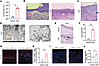 Establishment of an OLP-like mouse model.